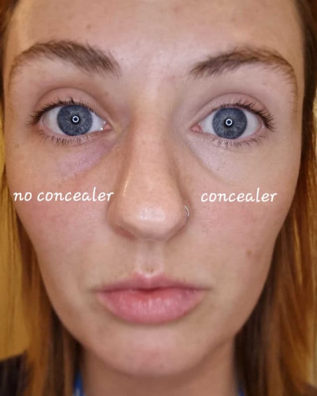 Nyx Cosmetics Bare With Me Concealer Serum review photo by ejabeauty