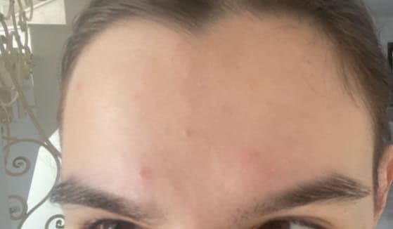 La Roche-Posay Anthelios XL Ultra-Light Body Spray Sunscreen SPF 50+ review photo by ilincaaaaa