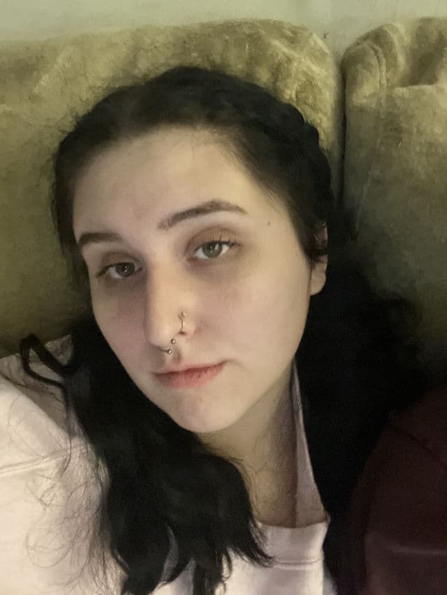 Murad Rapid Relief Acne Spot Treatment review photo by laurendorseyy