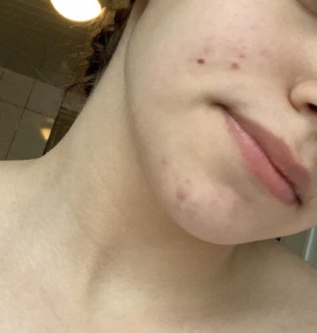 La Roche-Posay Cicaplast Baume B5 SPF50 review photo by seliiiiin