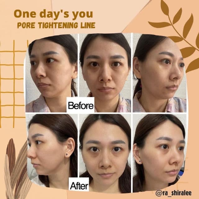 One-day's you Pore Tightening Ampoule Serum review photo by shiralee