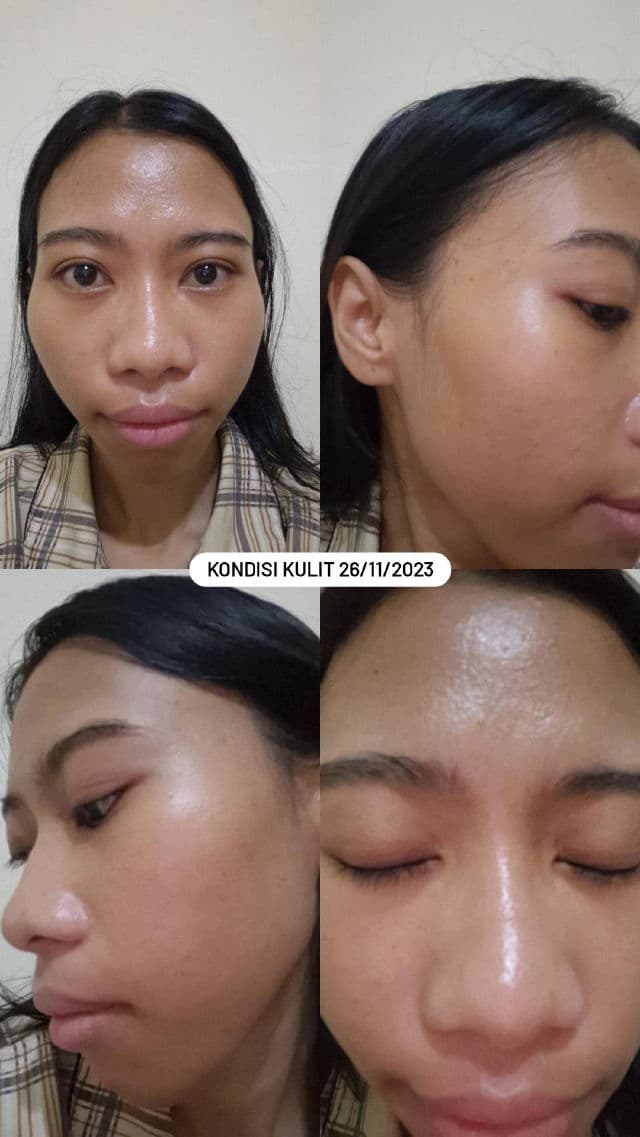 NATURE REPUBLIC Green Derma Tea Tree Cica Toner review photo by rensisflo