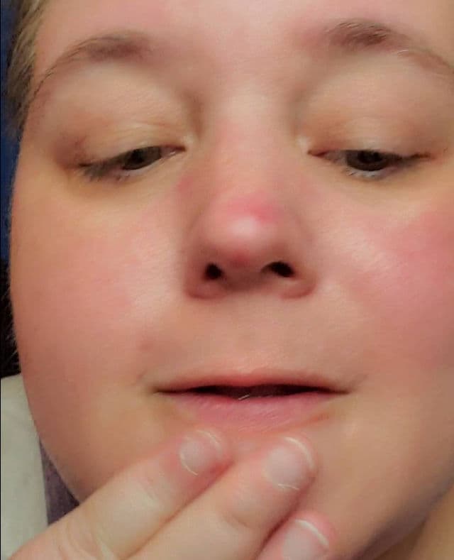 vividraw White Tomato Glutathione Radiance Ampoule review photo by DawnsReviews