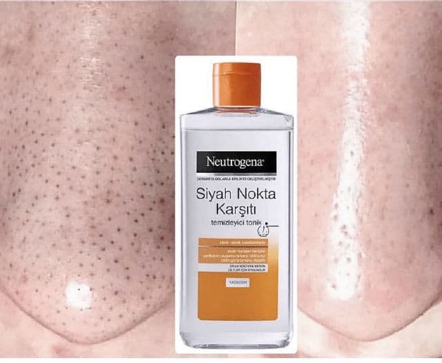 Neutrogena Blackhead Eliminating Cleansing Toner review photo by nesrin1