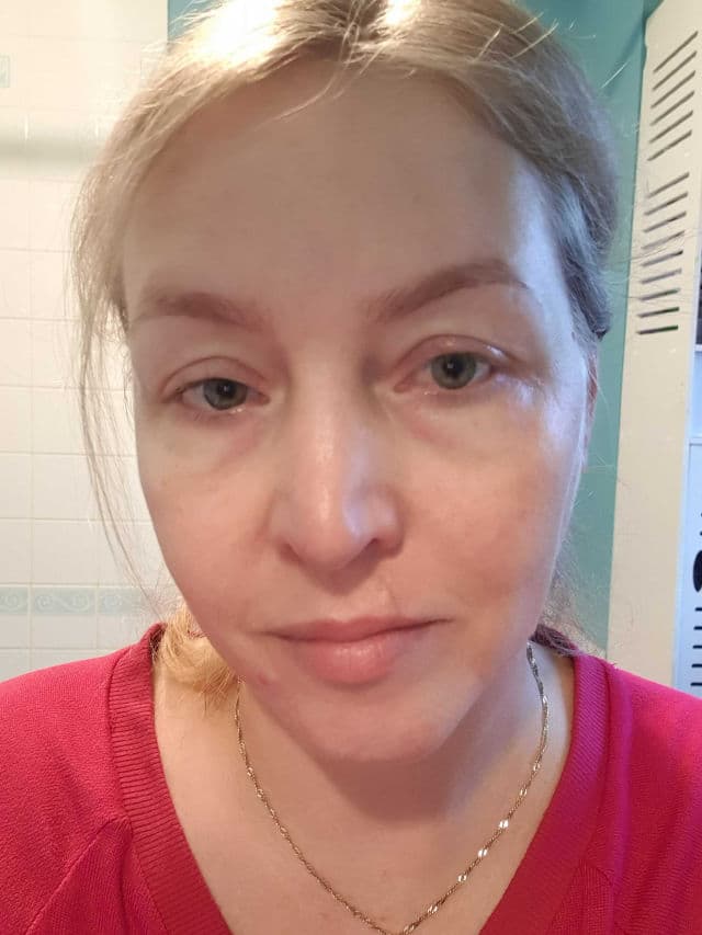 Vichy Neovadiol Meno 5 Bi-Serum review photo by DacealuK