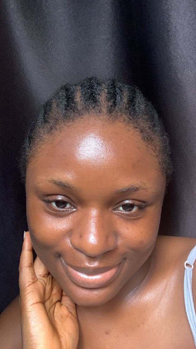 Good Molecules Discoloration Correcting Serum review photo by theoilyskingirlie