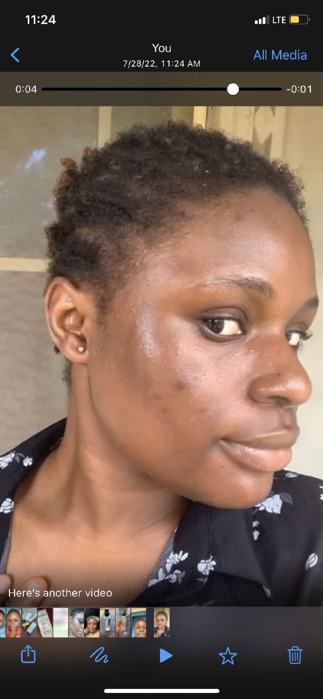 Good Molecules Discoloration Correcting Serum review photo by theoilyskingirlie