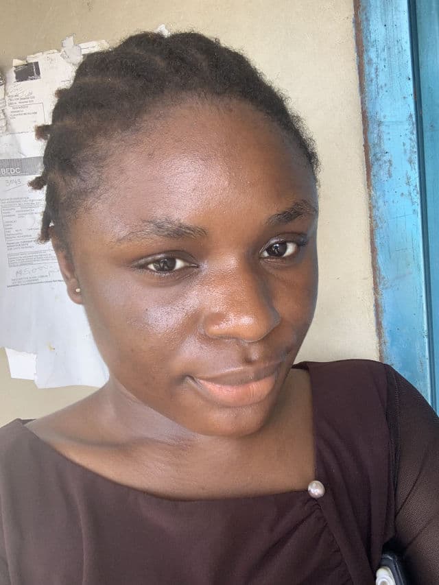 Good Molecules Discoloration Correcting Serum review photo by theoilyskingirlie