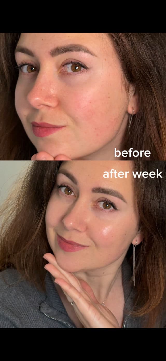 Centellian24 Madeca Cream Time Reverse Zero review photo by Olesiamerz