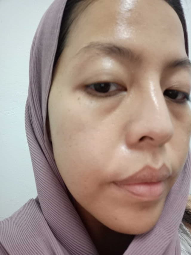 The Inkey List Glycolic Acid Liquid Toner review photo by skinXperimentbytheha