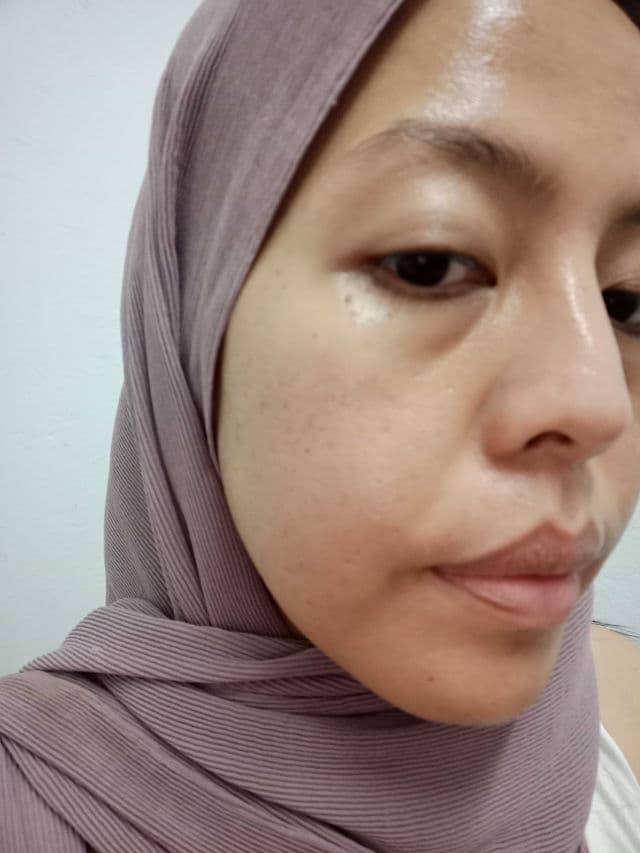 The Inkey List Glycolic Acid Liquid Toner review photo by skinXperimentbytheha