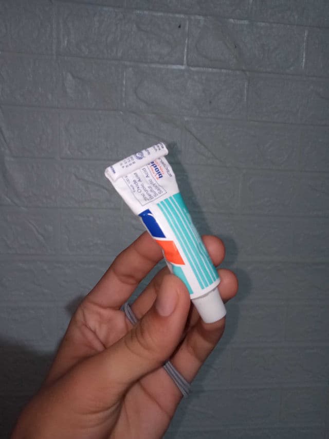 Bioderm Ointment review photo by emmanxtyles