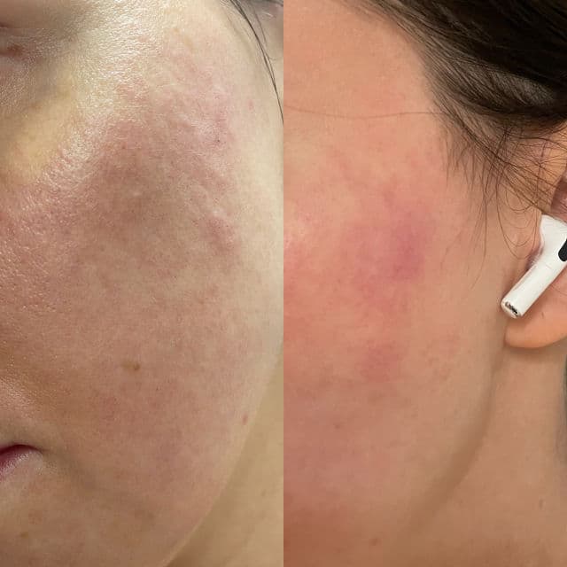 Clinique Clinique Smart Night™ Clinical MD Multi-Dimensional Repair Treatment Retinol review photo by annikalovesglow