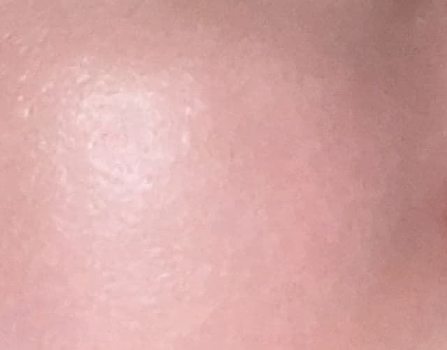 ESFOLIO 3HA Serum review photo by Oatmealcat