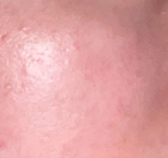 ESFOLIO 3HA Serum review photo by Oatmealcat