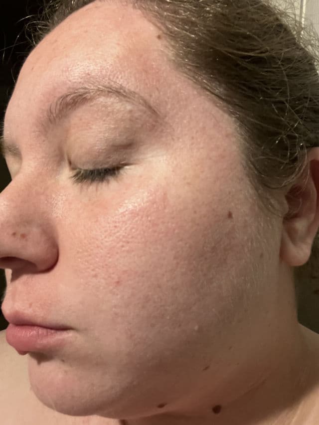 Rael Miracle Clear Exfoliating Cleanser  review photo by mackieboo