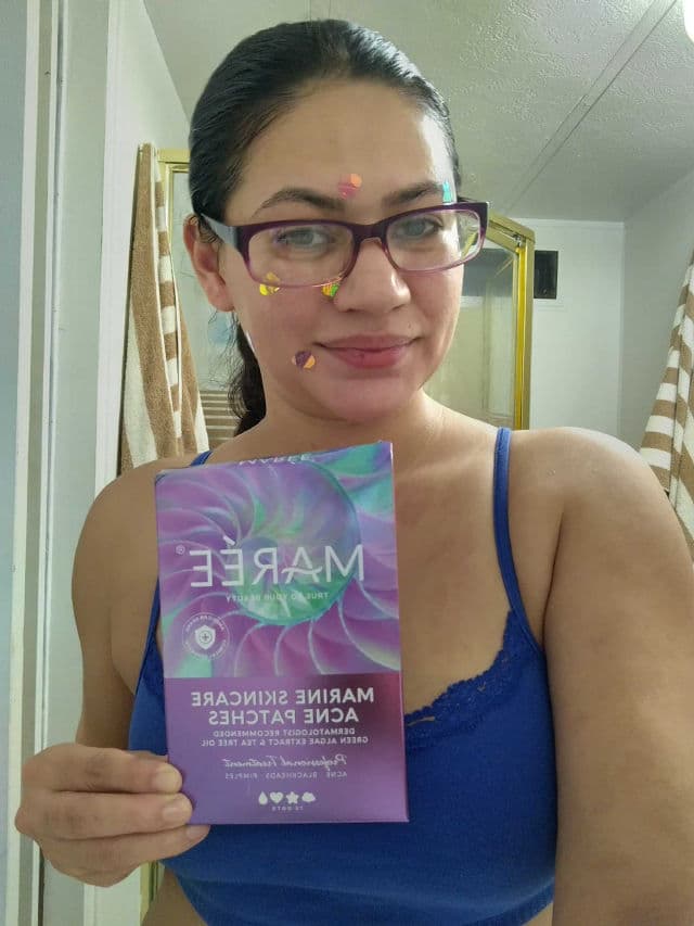 Marée Marine Skincare Acne Patches review photo by Rachel7leo