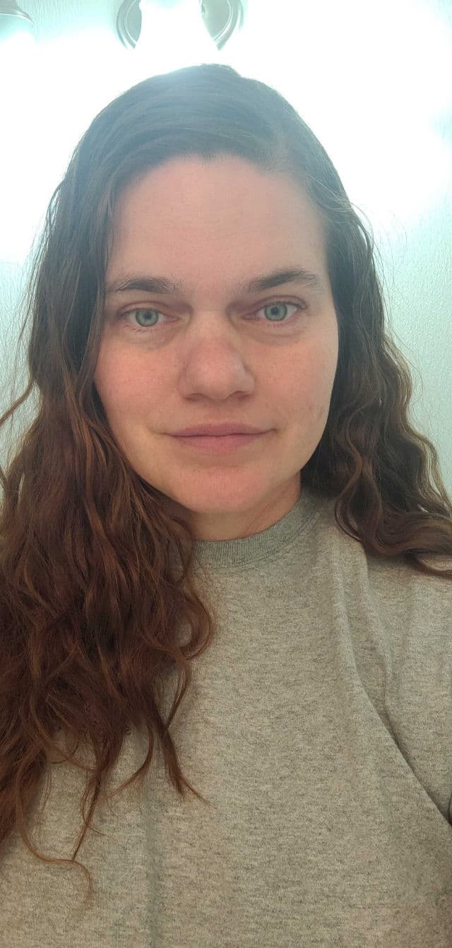 Koa Balancing Toner Pads review photo by junebug