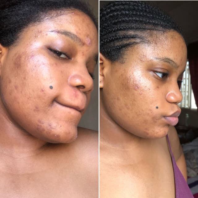 Topicals Faded Brightening & Clearing Serum review photo by Olabisi