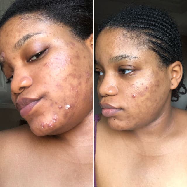 Topicals Faded Brightening & Clearing Serum review photo by Olabisi