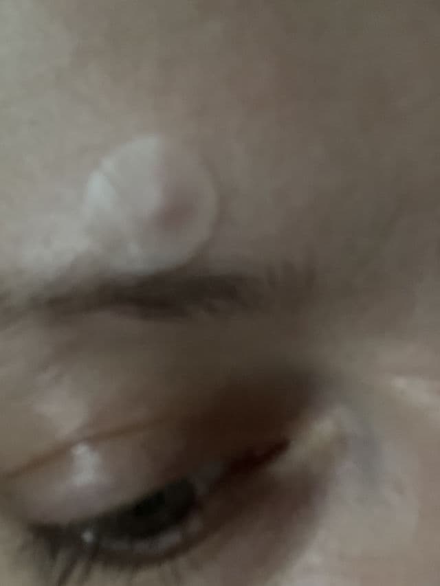 HANHOO Blemish Patch review photo by Halez