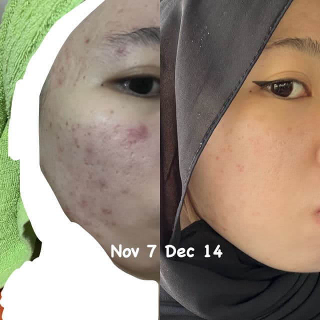 TATA GALTIER Bulaney Treatment Essence review photo by Riegiena