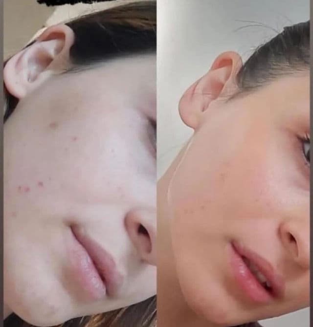 Luminesce Rejuvenation Serum review photo by mavireng