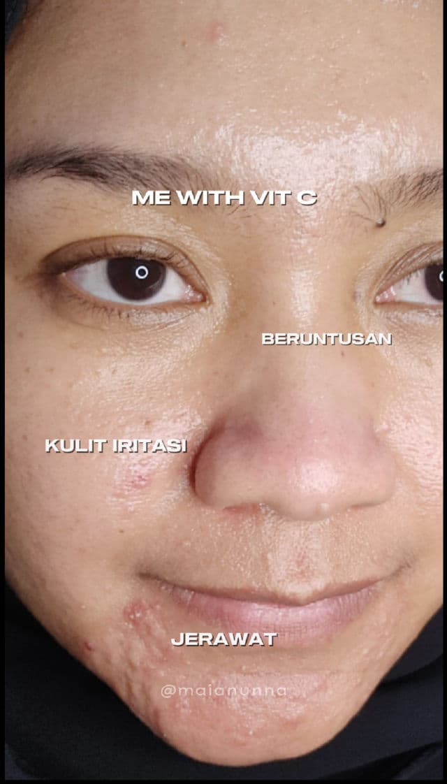 Revox Just Coenzyme Q10 review photo by maianunna