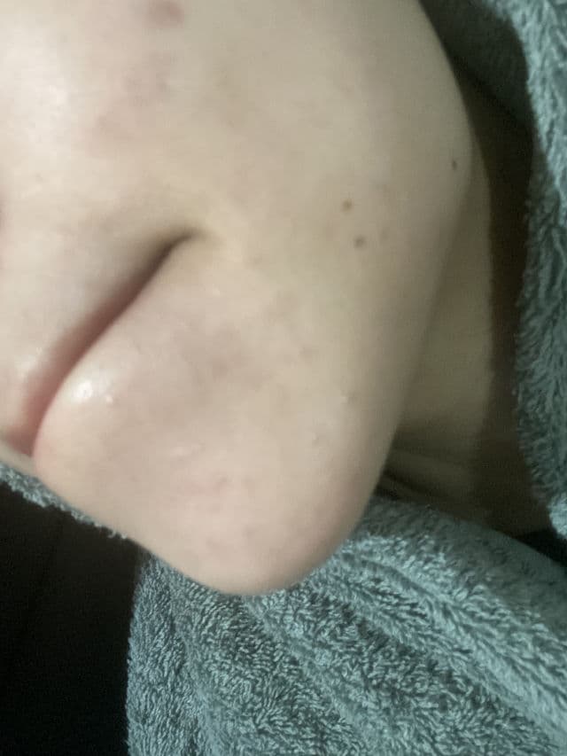 Cetaphil Daily Exfoliating Cleanser review photo by PickyUmii