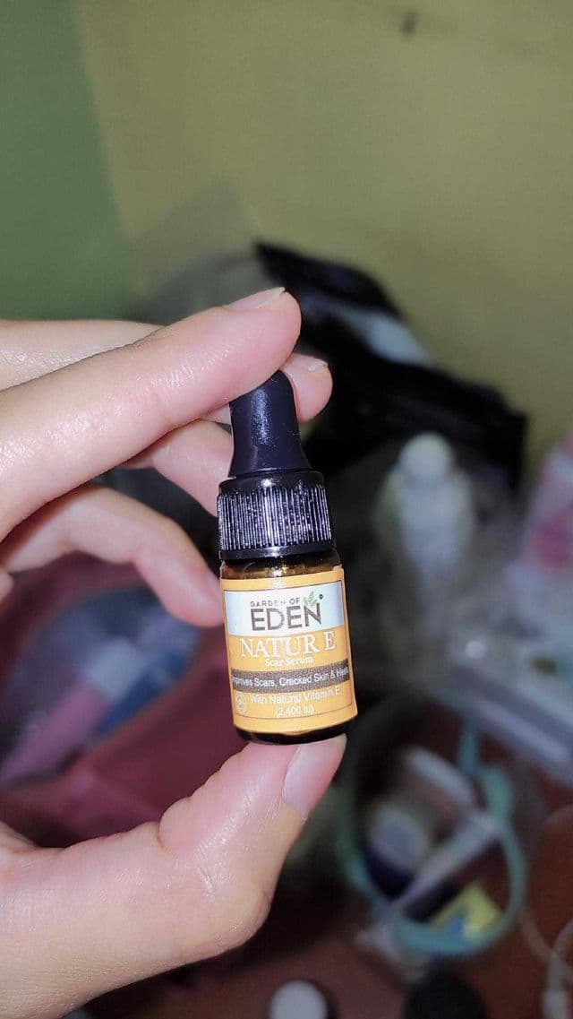 Garden of Eden Natur E Scar Serum review photo by syazana2808
