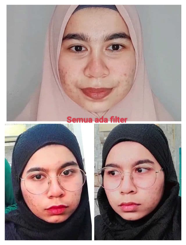 Rosken Sensitive Skin Cream review photo by Izzypizzy