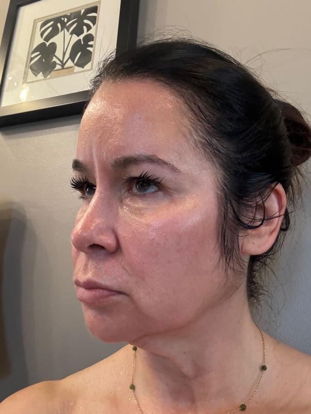 SkinMedica Lytera 2.0 Pigment Correcting Serum review photo by TerriC