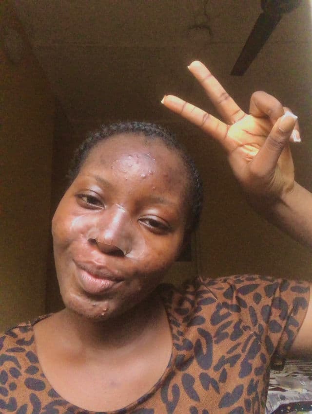 Glam Up Spotless Nose Patch review photo by AdekesDiary