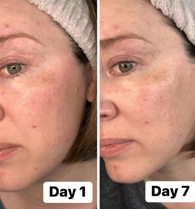 Dermalogica Phyto Nature Oxygen Cream review photo by Susan101