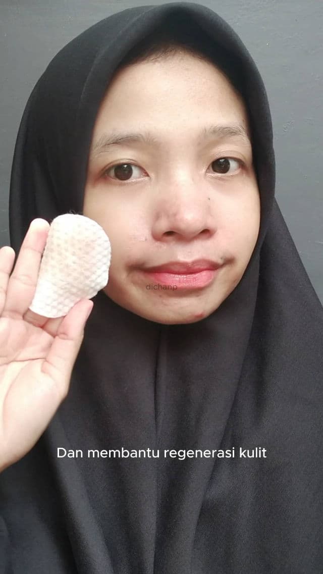 Base Daily Renewal Natural Exfoliating Pads review photo by dichanp