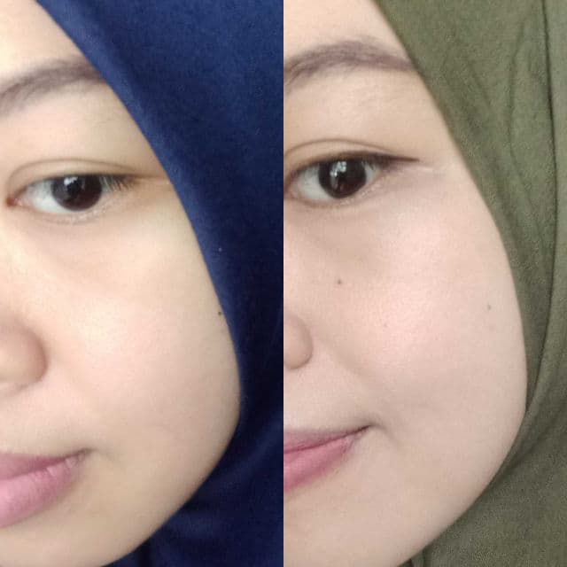 Garnier Bright Complete Anti-Acne Booster Serum review photo by alfiaminatun