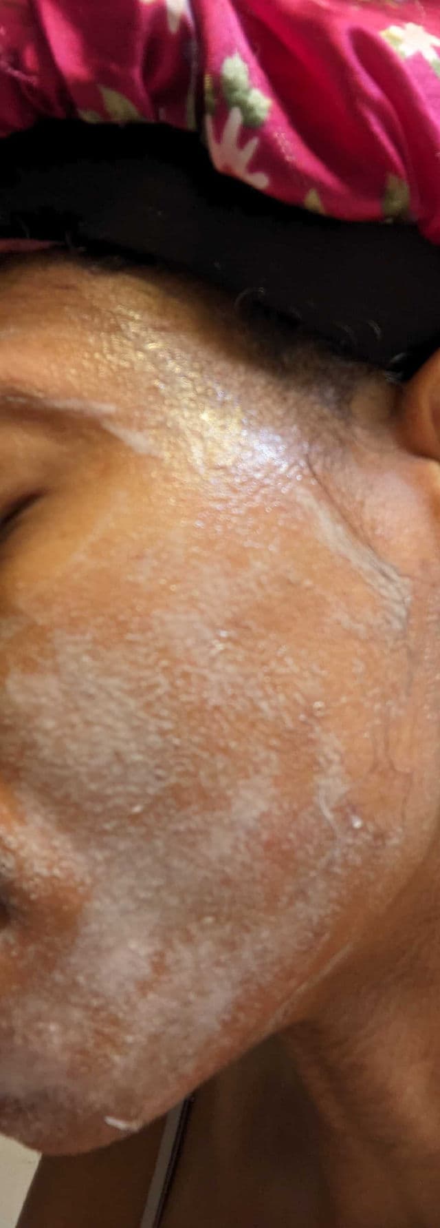 Hyper Skin Hyper Even Gentle Brightening Cleansing Gel review photo by ChillinWithQuanie