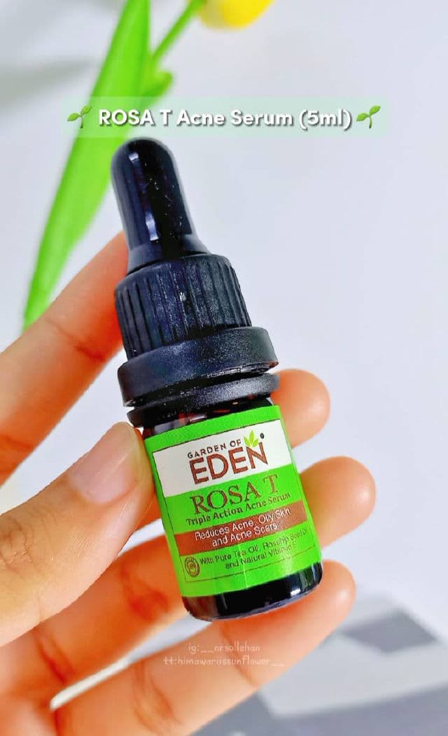 Garden of Eden Rosa T Triple Action Acne Serum review photo by nrsollehan
