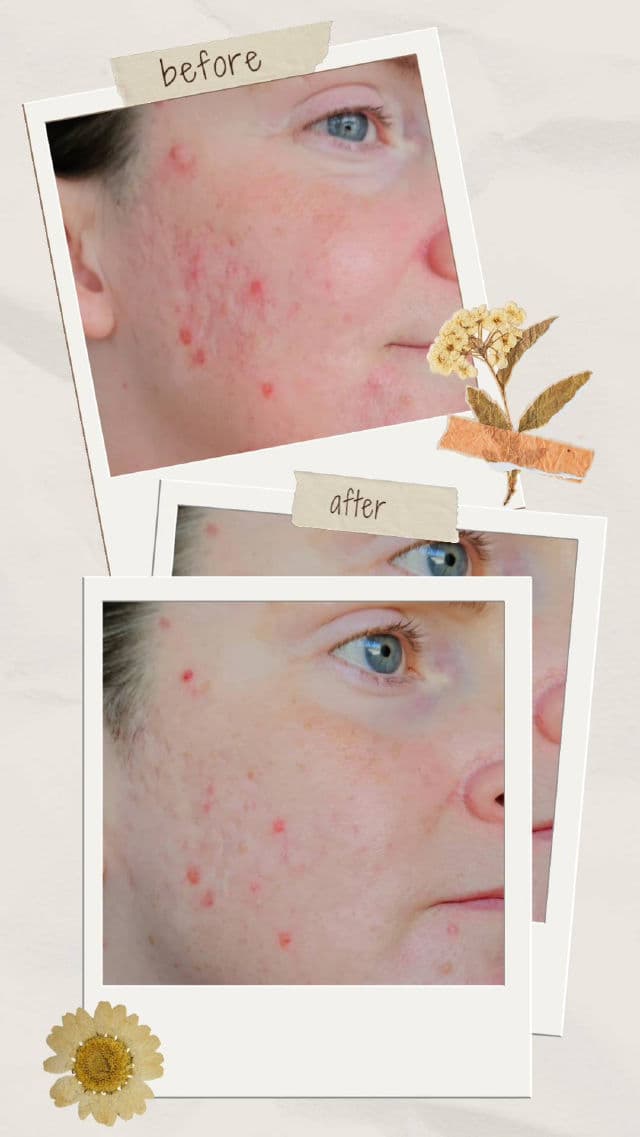 Celladix Sebum Rebalancing Rx 131 Ampoule review photo by ReviewedbyHanna