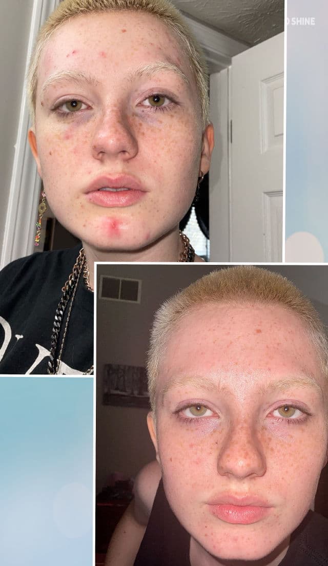 Good Molecules Glycolic Exfoliating Toner review photo by GraciousBean