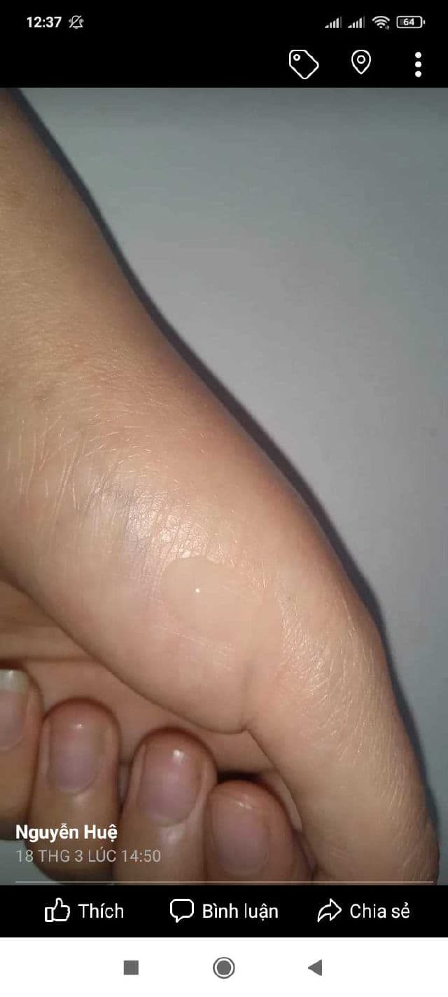 AXIS-Y Dark Spot Correcting Glow Serum review photo by Huenguyenrosie