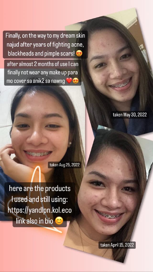 COSRX Salicylic Acid Exfoliating Cleanser review photo by ohtokaeee