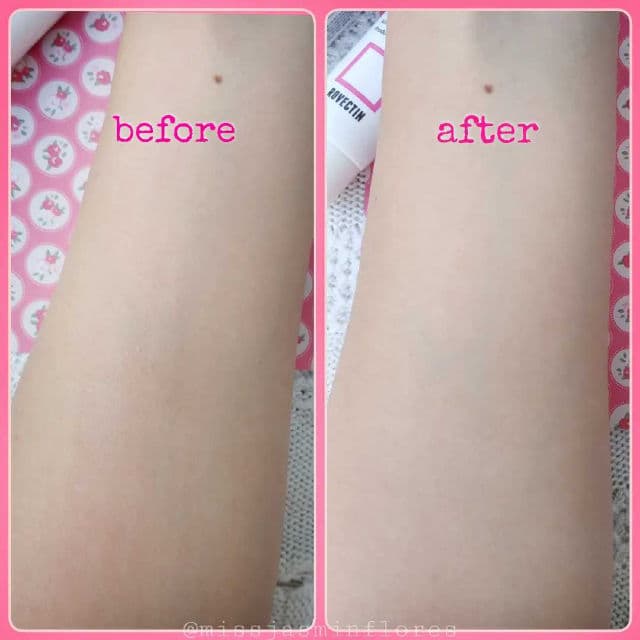 Rovectin Skin Essentials Cica Care Balm 40ml review photo by MissJazzy