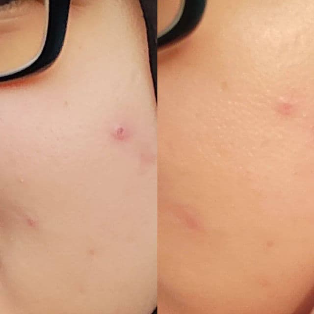 Yello Skincare Cynara Supple Plumping Essence review photo by Putriizhreen