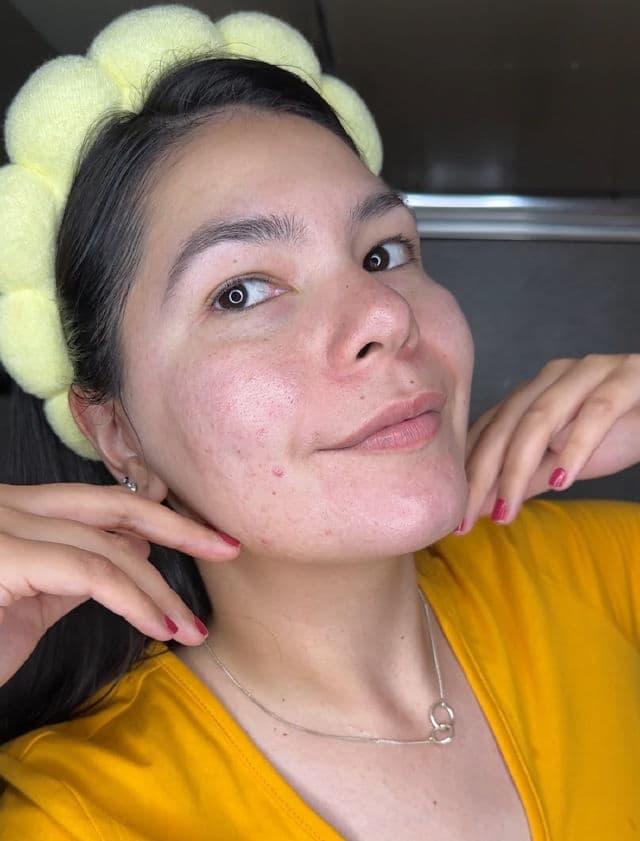 Meditherapy Vita Real Toning Enzyme Powder Cleanser review photo by rbkdevelasco