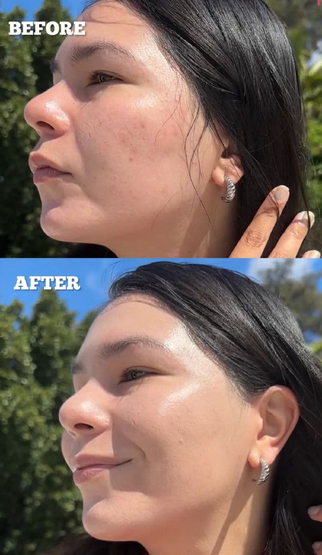 Cell Fusion C Skin Blemish Balm Intensive review photo by rbkdevelasco