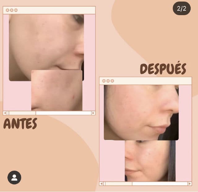 Nivea Cellular Luminous 630 Anti Dark Spot Gold Serum review photo by rbkdevelasco