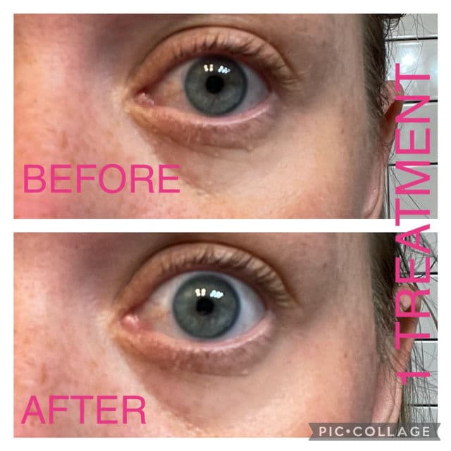 Marée Marine Collagen Eye Gels review photo by KaySmith