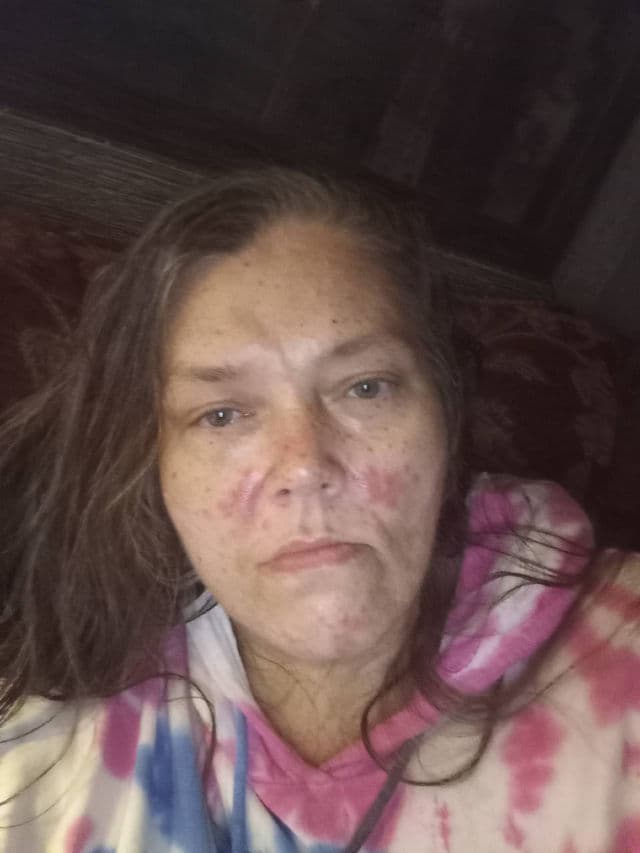 NeoStrata Restore Bionic Face Serum 10 PHA review photo by boobie