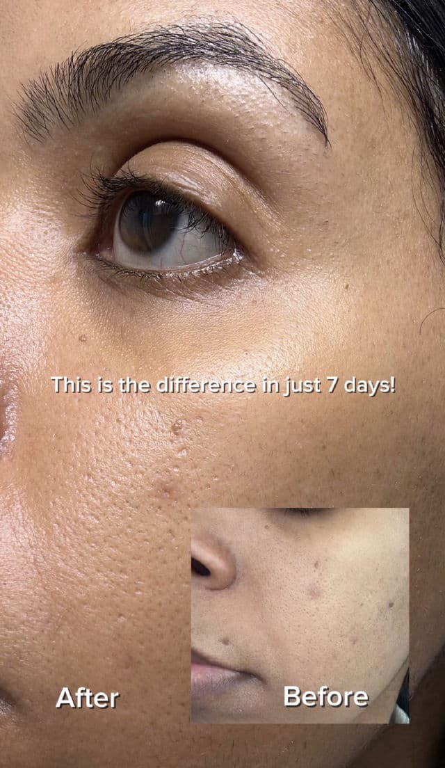 SKIN1004 Retinol 0.2 Boosting Shot Ampoule review photo by MayaraMagri